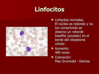 Linfocitos Linfocitos normales. El núcleo es redondo y no tan comprimido se observa un reborde basófilo (azulado) en el borde del citoplasma celular. Aumento: 400 veces Coloración: May Grunwald - Giemsa  