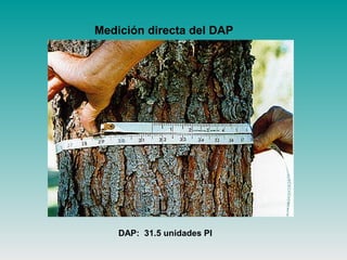 Medición directa del DAP
DAP: 31.5 unidades PI
 