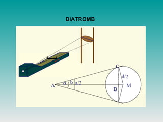 DIATROMB
 