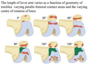 The length of lever arm varies as a function of geometry of
trochlea varying petallo femoral contact areas and the varying
centre of rotation of knee
 