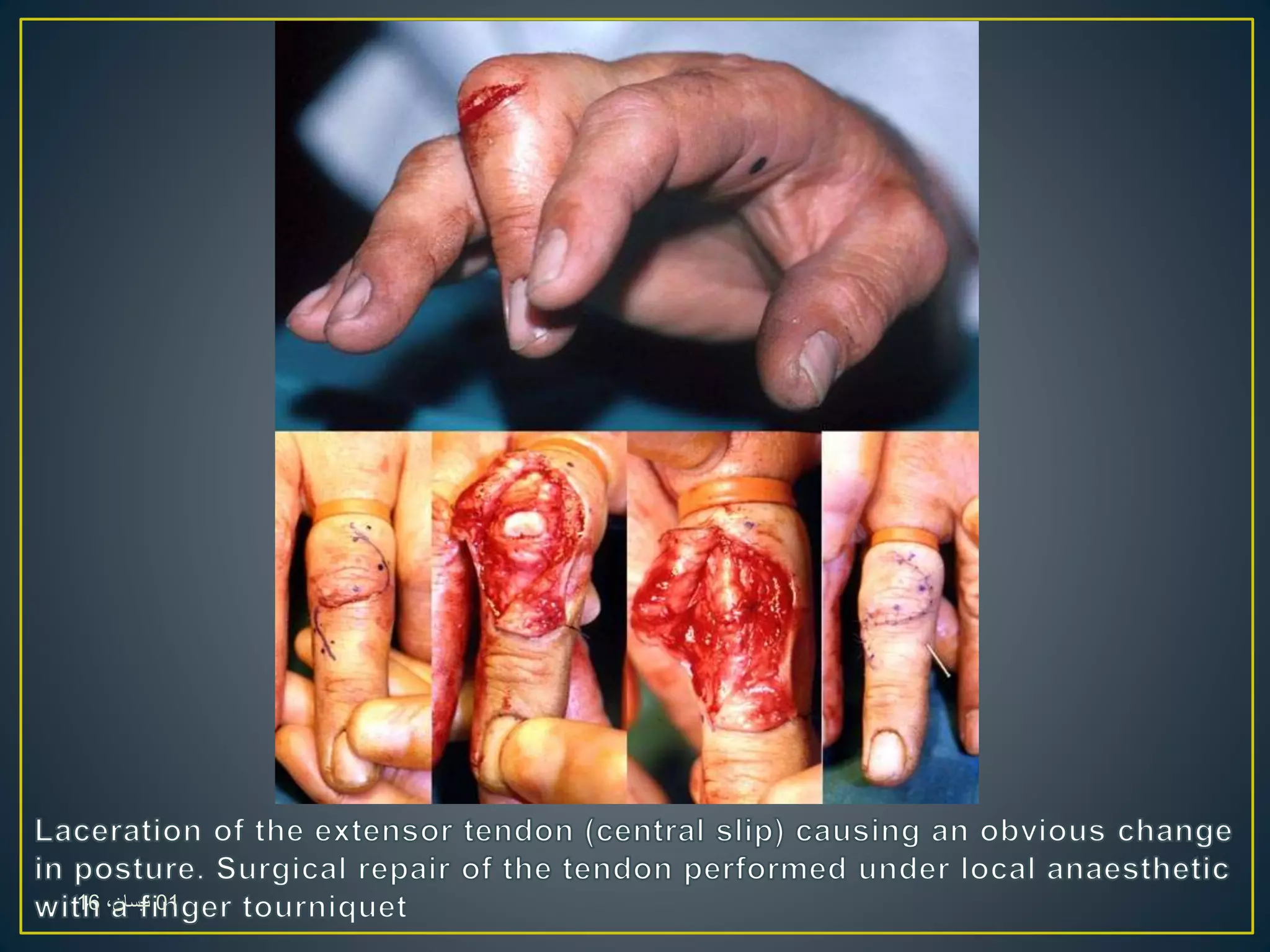 01،‫نيسان‬16
 