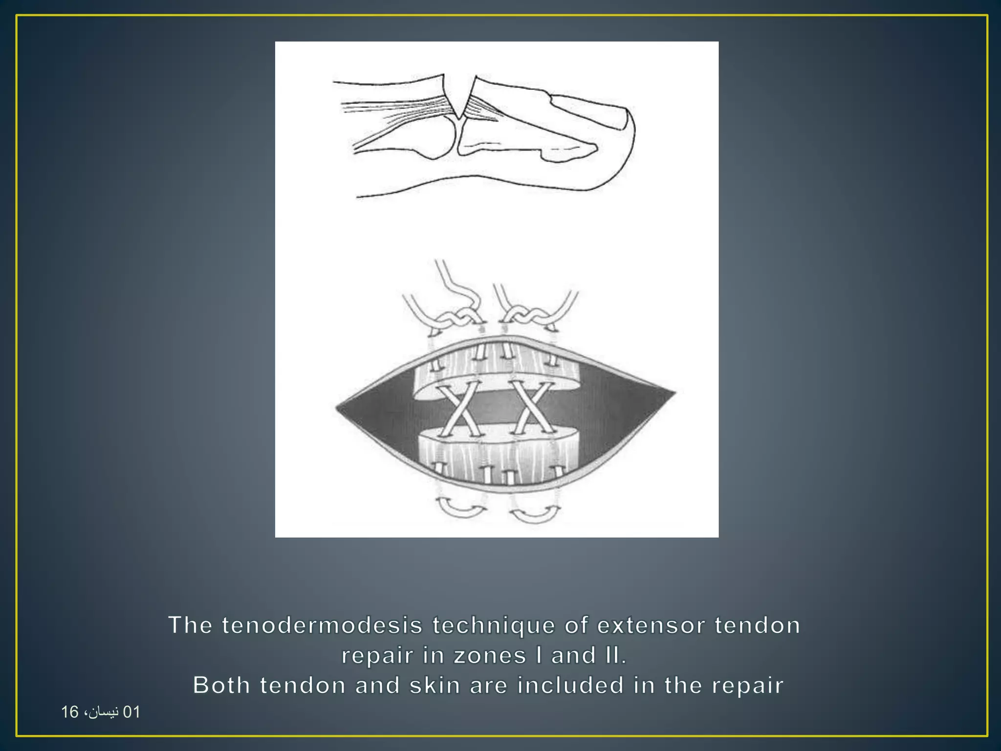 01،‫نيسان‬16
 