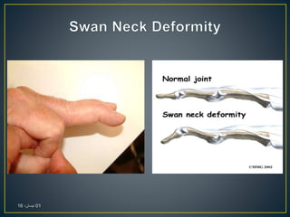 01،‫نيسان‬16
 