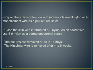 - Repair the extensor tendon with 4-0 monofilament nylon or 4-0
monofilament wire as a pull-out roll stitch.
- Close the skin with interrupted 5-0 nylon. As an alternative,
use 4-0 nylon as a dermotenodermal suture.
- The sutures are removed at 10 to 14 days.
The Kirschner wire is removed after 4 to 6 weeks.
01،‫نيسان‬16
 