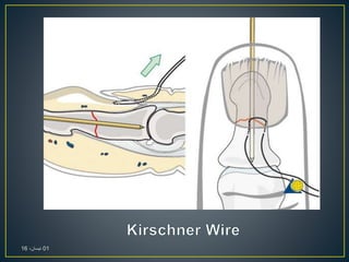01،‫نيسان‬16
 