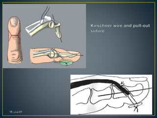 01،‫نيسان‬16
 