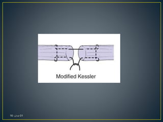 01،‫نيسان‬16
 
