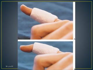 01،‫نيسان‬16
 