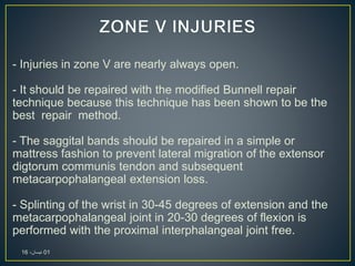 - Injuries in zone V are nearly always open.
- It should be repaired with the modified Bunnell repair
technique because this technique has been shown to be the
best repair method.
- The saggital bands should be repaired in a simple or
mattress fashion to prevent lateral migration of the extensor
digtorum communis tendon and subsequent
metacarpophalangeal extension loss.
- Splinting of the wrist in 30-45 degrees of extension and the
metacarpophalangeal joint in 20-30 degrees of flexion is
performed with the proximal interphalangeal joint free.
01،‫نيسان‬16
 