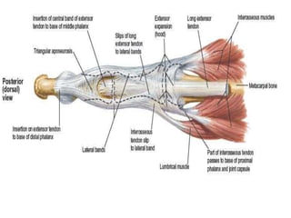 Strained Extensor Tendon Extensor tendon injuries hand | PPTX