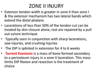 ZONE II INJURY
• Extensor tendon width is greater in zone II than zone I
& the extensor mechanism has two lateral bands which
extend the distal phalanx
• Lacerations of less than 50% of the tendon cut can be
treated by skin closure alone, rest are repaired by a pull
out suture technique
• Typically seen in conjunction with sharp lacerations,
saw injuries, and crushing injuries
• The DIP is splinted in extension for 4 to 6 weeks
• Turrent Exostosis is a mass of bone formed secondary
to a periosteum injury in a zone II laceration. This mass
limits DIP flexion and resection is the treatment of
choice
 