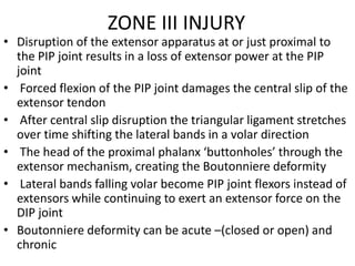 ZONE III INJURY
• Disruption of the extensor apparatus at or just proximal to
the PIP joint results in a loss of extensor power at the PIP
joint
• Forced flexion of the PIP joint damages the central slip of the
extensor tendon
• After central slip disruption the triangular ligament stretches
over time shifting the lateral bands in a volar direction
• The head of the proximal phalanx ‘buttonholes’ through the
extensor mechanism, creating the Boutonniere deformity
• Lateral bands falling volar become PIP joint flexors instead of
extensors while continuing to exert an extensor force on the
DIP joint
• Boutonniere deformity can be acute –(closed or open) and
chronic
 
