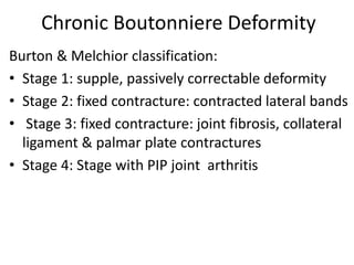 Chronic Boutonniere Deformity
Burton & Melchior classification:
• Stage 1: supple, passively correctable deformity
• Stage 2: fixed contracture: contracted lateral bands
• Stage 3: fixed contracture: joint fibrosis, collateral
ligament & palmar plate contractures
• Stage 4: Stage with PIP joint arthritis
 