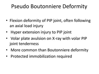 Pseudo Boutonniere Deformity
• Flexion deformity of PIP joint, often following
an axial load injury
• Hyper extension injury to PIP joint
• Volar plate avulsion on X-ray with volar PIP
joint tenderness
• More common than Boutonniere deformity
• Protected immobilization required
 