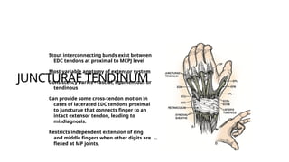 Comprehensive Principles and Techniques of Extensor Tendon Repair in ...