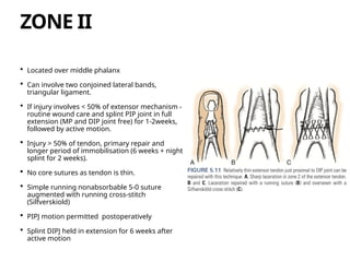 Extensor tendon anatomy, injury and its mangement pptx | PPTX