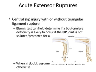 Comprehensive Management of Extensor Tendon Injuries: Repair ...