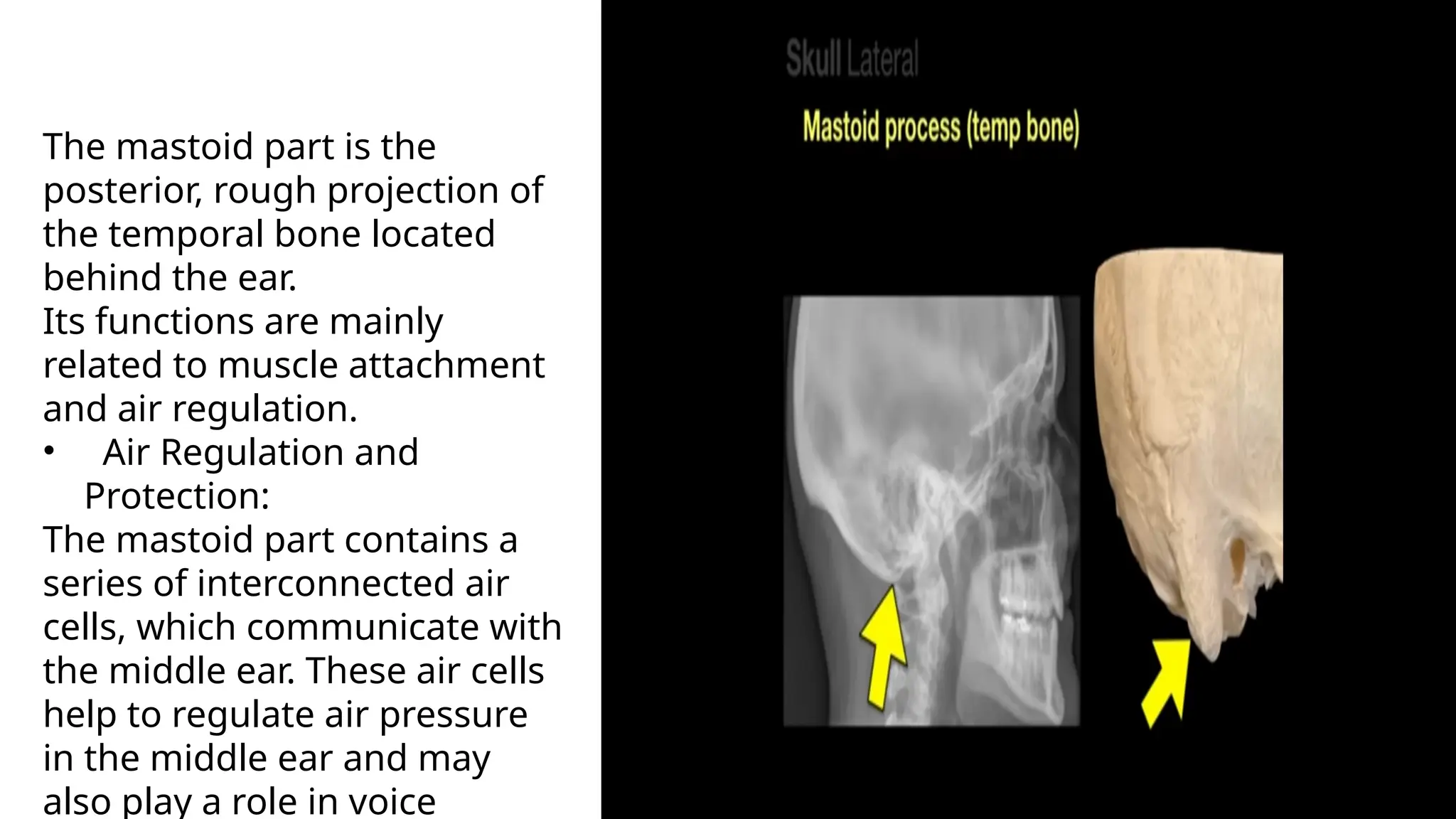 exterior of skull (skull views anterior posterior and lateral) | PPTX