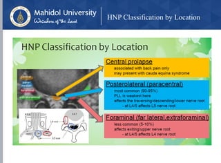 HNP Classification by Location
 