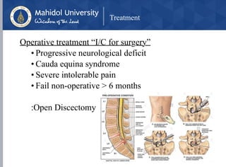 Treatment
Operative treatment “I/C for surgery”
• Progressive neurological deficit
• Cauda equina syndrome
• Severe intolerable pain
• Fail non-operative > 6 months
:Open Discectomy
 