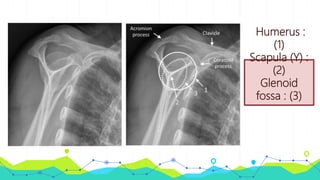 Humerus :
(1)
Scapula (Y) :
(2)
Glenoid
fossa : (3)
 