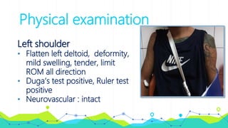 Physical examination
Left shoulder
• Flatten left deltoid, deformity,
mild swelling, tender, limit
ROM all direction
• Duga’s test positive, Ruler test
positive
• Neurovascular : intact
 