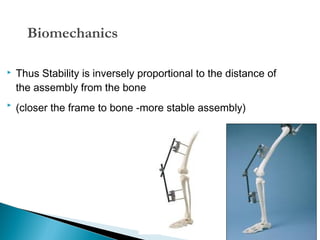 Biomechanics


Thus Stability is inversely proportional to the distance of
the assembly from the bone



(closer the frame to bone -more stable assembly)

15

 