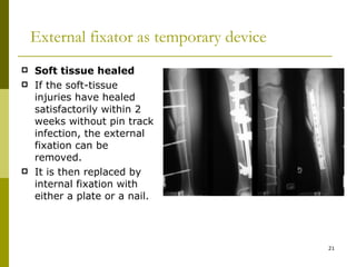 External fixator | PPT