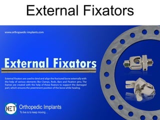 External Fixators
 