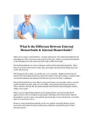 What Is the Difference Between External
Hemorrhoids & Internal Hemorrhoids?
There are two types of hemorrhoids - external and internal. An external hemorrhoid is the
inflammation of the soft tissue on the outside of the anus, whereas an internal hemorrhoid
is the inflammation of the anal tissue that resides within the rectum.
External hemorrhoids are easier to diagnose and treat than internal hemorrhoids. Since
they are located on the exterior of the anus, the bumps caused by blood filling the tissue
can be felt and seen.
The bumps, known as piles, are usually raw, sore, and itchy. Bright red blood may be
found on the toilet paper following a bowel movement. Pain when sitting is common with
external hemorrhoids and getting rid of them for good can feel like a nightmare.
External hemorrhoids are more likely to respond to home-care remedies such as over-the-
counter products (creams, pads, etc.), sitz baths, and good personal hygiene practices.
These remedies alleviate the discomfort and the hemorrhoids usually disappear entirely
within a few weeks.
Many cases of internal hemorrhoids are not painful and are not noticed until blood
appears in the stools or streaked on toilet paper following a bowel movement. Internal
hemorrhoids can also cause a non-painful, persistent urge to move the bowels, even when
there is no necessity to do so.
However, large internal hemorrhoids can be very painful, especially during a bowel
movement, and cannot be treated with creams, ointments, and pads because of their
internal location.
 