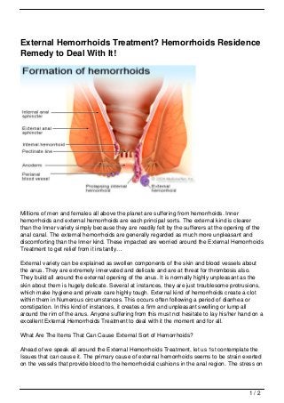 External Hemorrhoids Treatment? Hemorrhoids Residence
Remedy to Deal With It!




Millions of men and females all above the planet are suffering from hemorrhoids. Inner
hemorrhoids and external hemorrhoids are each principal sorts. The external kind is clearer
than the Inner variety simply because they are readily felt by the sufferers at the opening of the
anal canal. The external hemorrhoids are generally regarded as much more unpleasant and
discomforting than the Inner kind. These impacted are worried around the External Hemorrhoids
Treatment to get relief from it instantly…

External variety can be explained as swollen components of the skin and blood vessels about
the anus. They are extremely innervated and delicate and are at threat for thrombosis also.
They build all around the external opening of the anus. It is normally highly unpleasant as the
skin about them is hugely delicate. Several at instances, they are just troublesome protrusions,
which make hygiene and private care highly tough. External kind of hemorrhoids create a clot
within them in Numerous circumstances. This occurs often following a period of diarrhea or
constipation. In this kind of instances, it creates a firm and unpleasant swelling or lump all
around the rim of the anus. Anyone suffering from this must not hesitate to lay his/her hand on a
excellent External Hemorrhoids Treatment to deal with it the moment and for all.

What Are The Items That Can Cause External Sort of Hemorrhoids?

Ahead of we speak all around the External Hemorrhoids Treatment, let us 1st contemplate the
Issues that can cause it. The primary cause of external hemorrhoids seems to be strain exerted
on the vessels that provide blood to the hemorrhoidal cushions in the anal region. The stress on




                                                                                            1/2
 