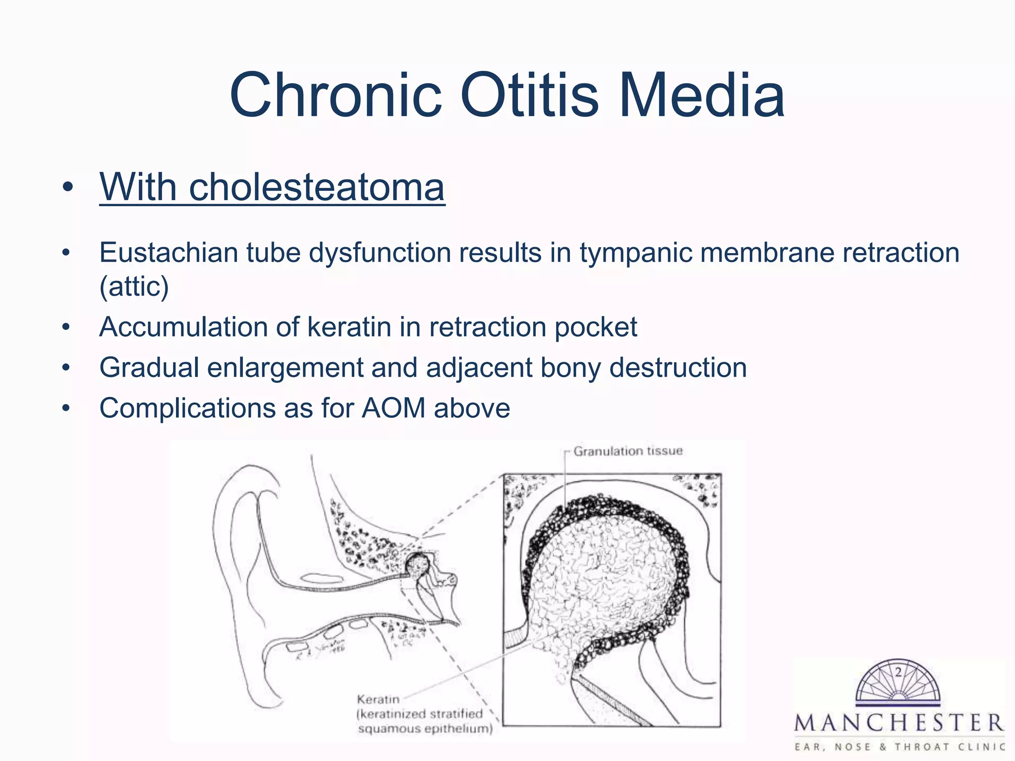 External and middle ear disease for g ps | PPTX
