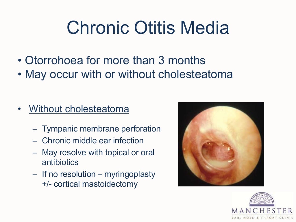 External and middle ear disease for g ps
