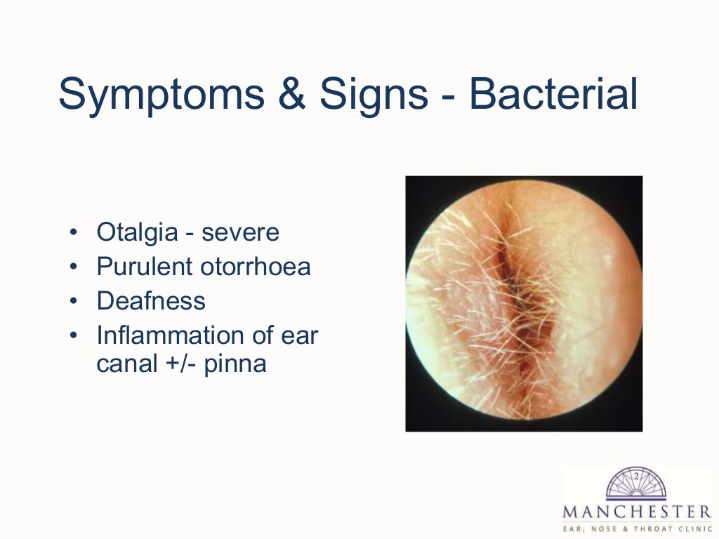 External and middle ear disease for g ps