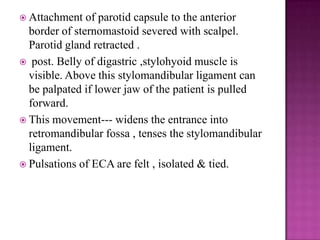  Attachment

of parotid capsule to the anterior
border of sternomastoid severed with scalpel.
Parotid gland retracted .
 post. Belly of digastric ,stylohyoid muscle is
visible. Above this stylomandibular ligament can
be palpated if lower jaw of the patient is pulled
forward.
 This movement--- widens the entrance into
retromandibular fossa , tenses the stylomandibular
ligament.
 Pulsations of ECA are felt , isolated & tied.

 