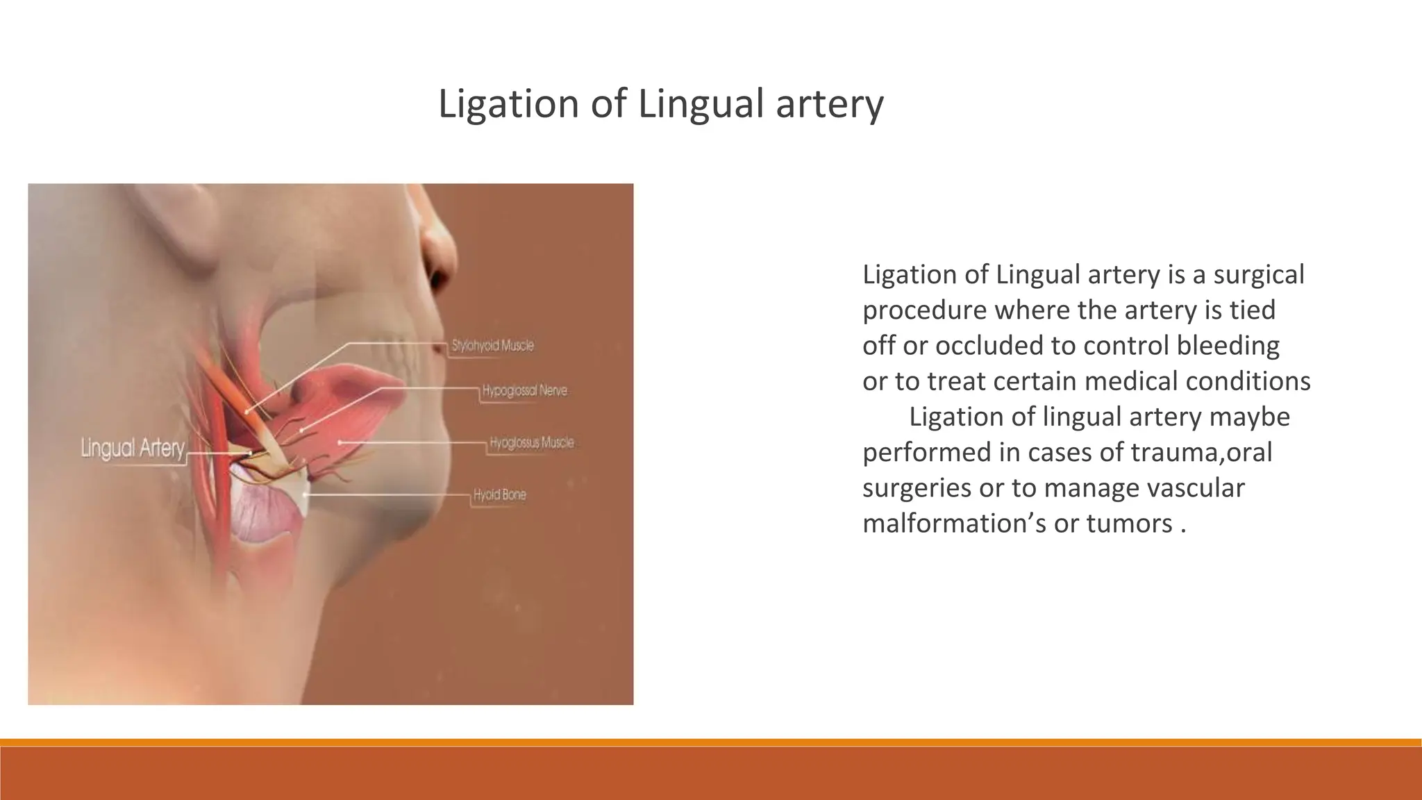 External carotid artery , ligation of External carotid artery, lingual ...