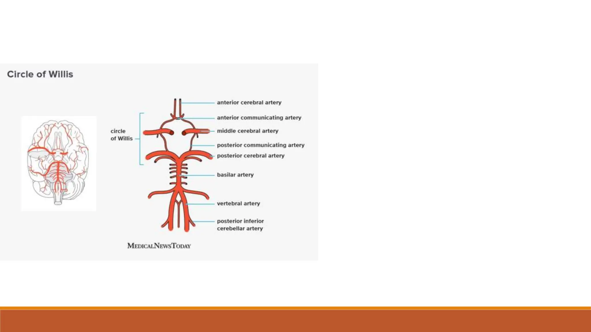 External carotid artery , ligation of External carotid artery, lingual ...