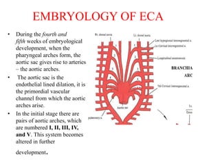 External Carotid Artery Ligation