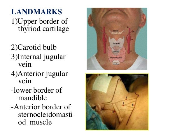 External carotid artery, branches and ligation