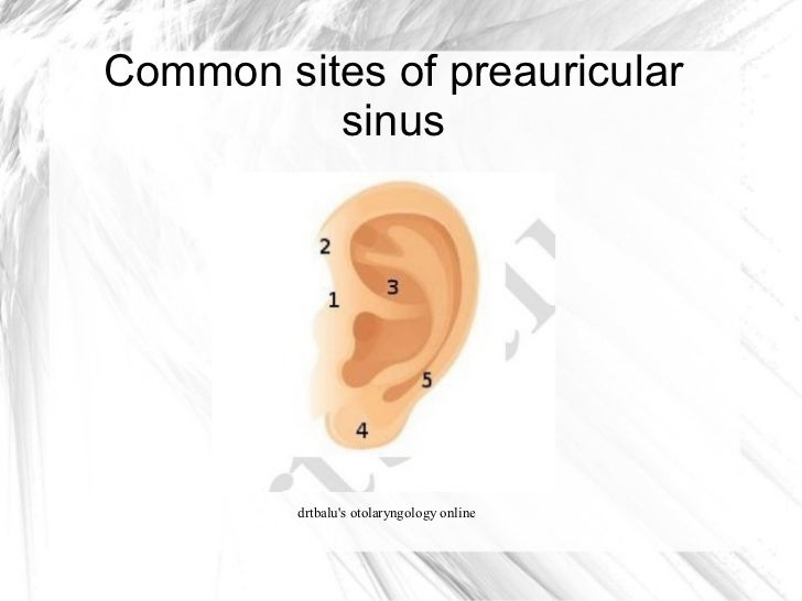 Diseases of external ear