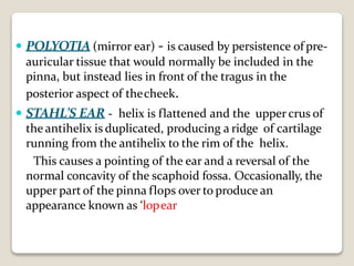  POLYOTIA (mirror ear) - is caused by persistence of pre-
auricular tissue that would normally be included in the
pinna, but instead lies in front of the tragus in the
posterior aspect of thecheek.
 STAHL’S EAR - helix is flattened and the upper crus of
the antihelix is duplicated, producing a ridge of cartilage
running from the antihelix to the rim of the helix.
This causes a pointing of the ear and a reversal of the
normal concavity of the scaphoid fossa. Occasionally, the
upper part of the pinna flops over to produce an
appearance known as ‘lopear
 