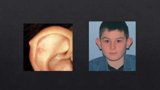 External ear anatomy