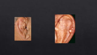 External ear anatomy