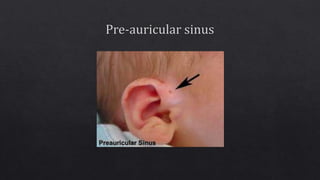 External ear anatomy