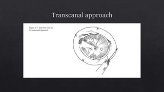 External ear anatomy