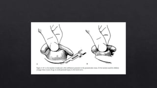 External ear anatomy