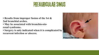 preauricular sinus
• Results from improper fusion of the 1st &
2nd branchial arches.
• May be associated with branchio-oto-
renal syndrome.
• Surgery is only indicated when it is complicated by
recurrent infection or abscess.
 