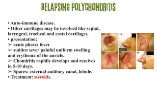 Relapsing polychondritis
• Auto-immune disease.
• Other cartilages may be involved like septal,
laryngeal, tracheal and costal cartilages.
• presentation:
➢ acute phase: fever
➢ sudden sever painful uniform swelling
and erythema of the auricle.
➢ Chondritis rapidly develops and resolves
in 5-10 days.
➢ Spares: external auditory canal, lobule.
• Treatment: steroids.
 