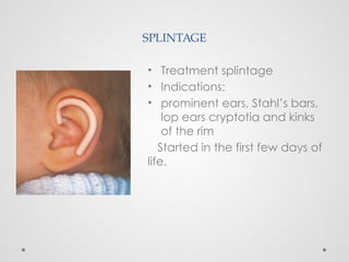 SPLINTAGE
• Treatment splintage
• Indications:
• prominent ears, Stahl’s bars,
lop ears cryptotia and kinks
of the rim
Started in the first few days of
life.
 