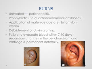 BURNS
• Untreated perichondritis.
• Prophylactic use of antipseudomonal antibiotics.).
• Application of mafenide acetate (Sulfamylon)
cream.
• Débridement and skin grafting.
• Failure to evacuate blood within 7-10 days -
secondary changes in the perichondrium and
cartilage & permanent deformity.
 